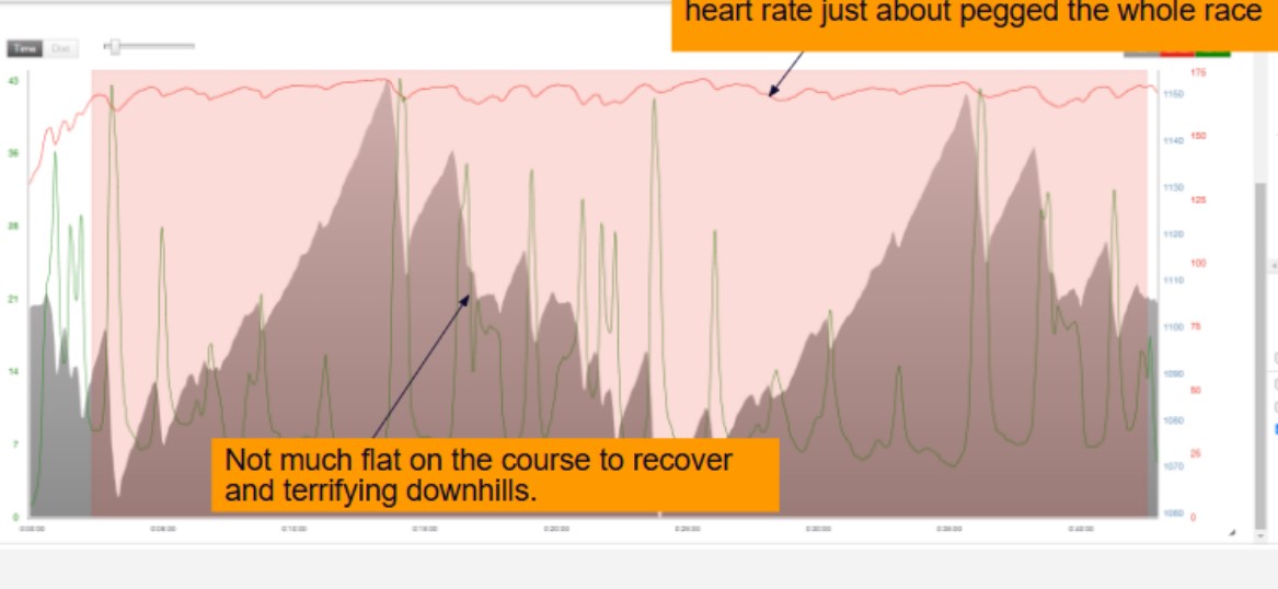 Heart rate